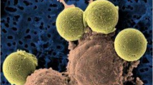 Cell丨黑色素瘤细胞会表达PD-1？还会促进肿瘤生长？震惊了！