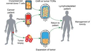 免疫治疗黑科技：终于攻克实体瘤？