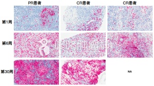 PD-1联合溶瘤病毒有效率62%，然后呢？