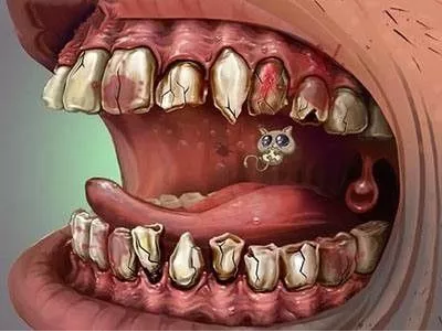 口腔癌主要包括舌癌,颊癌,牙龈癌,腭癌,唇癌,上下颌骨癌,口底癌等.