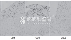 大救星：这药能解PD1致死性副作用