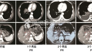 基因突变还分顺反？顺手教你破解之道