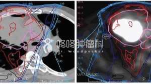 PET原来可以这么用：控制率提高30%