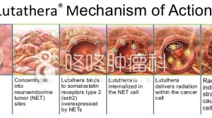 放射性药物Lutathera上市：癌友死亡风险砍半