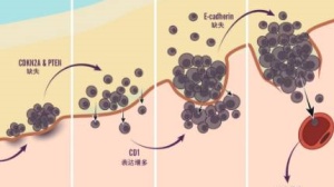 这些遍布全身不起眼的小“玩意”，有时可能成为致命杀手！