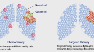 肺癌常用的靶向药有哪些？