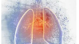 022 v5 NCCN肺癌指南：新辅助免疫治疗又添新选择！