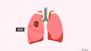 一代/二代EGFR-TKI耐药后，肺癌三代TKI如何选择？