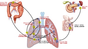 罹患“癌王”，多次复发、6次手术，80岁老人带瘤生存10余年，瑞金医院张俊团队揭秘生存密码！