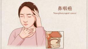 患者生存率提升近20%，中国鼻咽癌研究再登《柳叶刀》