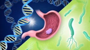 存在这类基因突变，更容易患上胃癌！