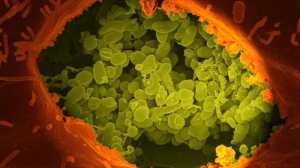 研究表明肠道细菌是对抗结直肠癌的关键